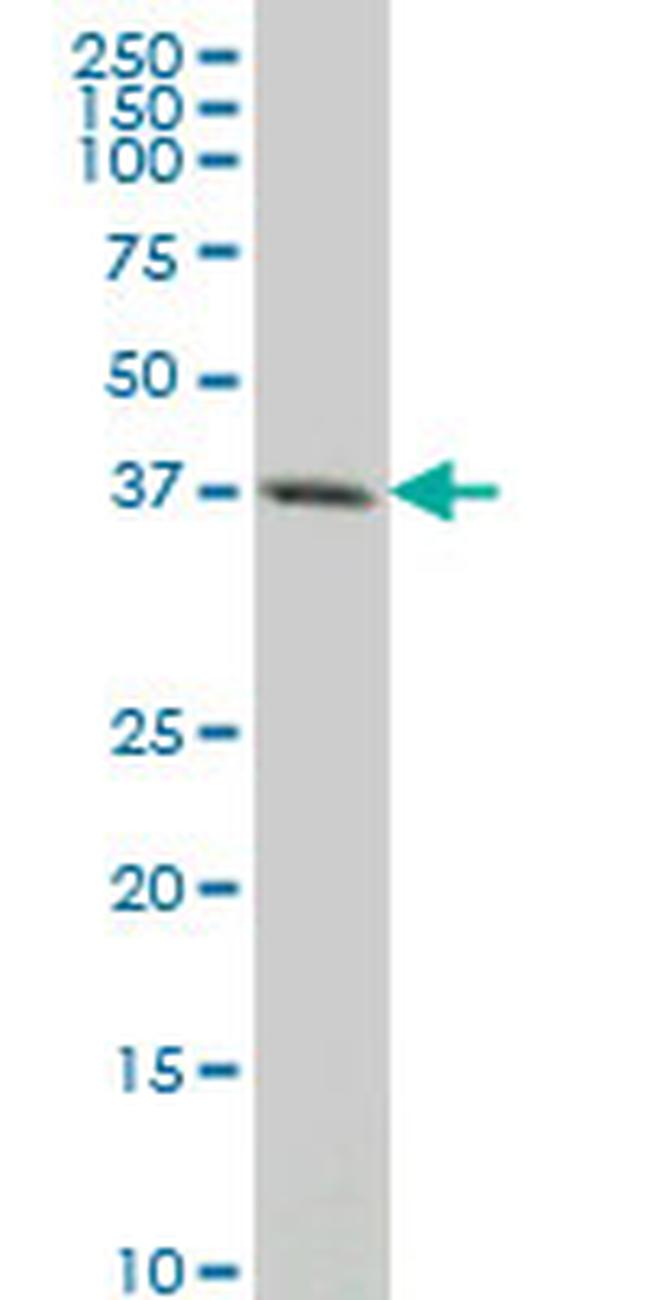 CXCR4 Antibody in Western Blot (WB)