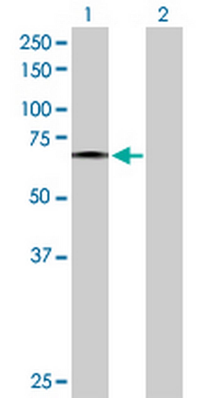 FZD5 Antibody in Western Blot (WB)