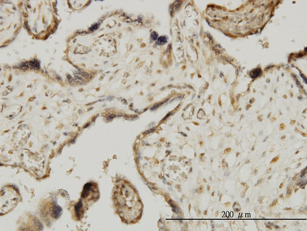 MAPKAPK3 Antibody in Immunohistochemistry (Paraffin) (IHC (P))