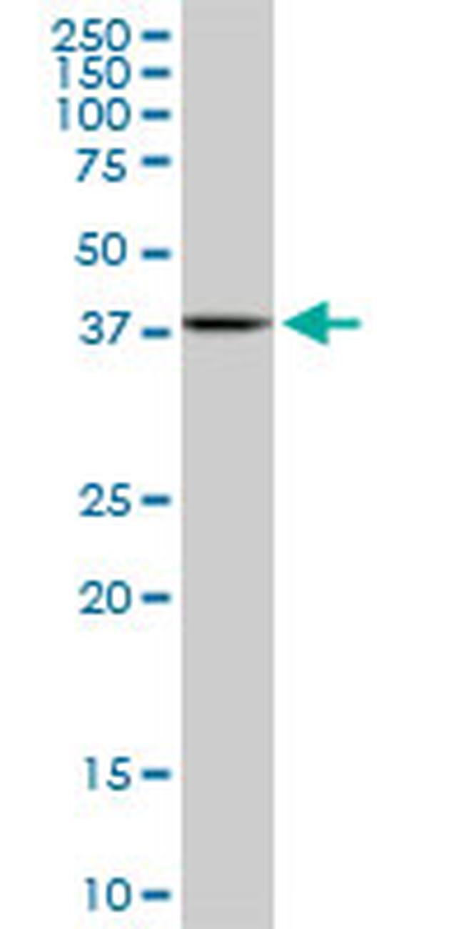 MAPKAPK3 Antibody in Western Blot (WB)