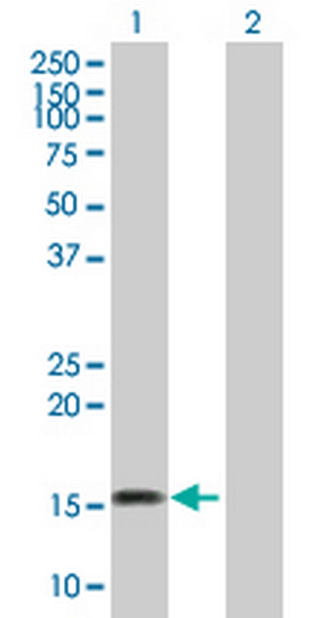 ARMET Antibody in Western Blot (WB)