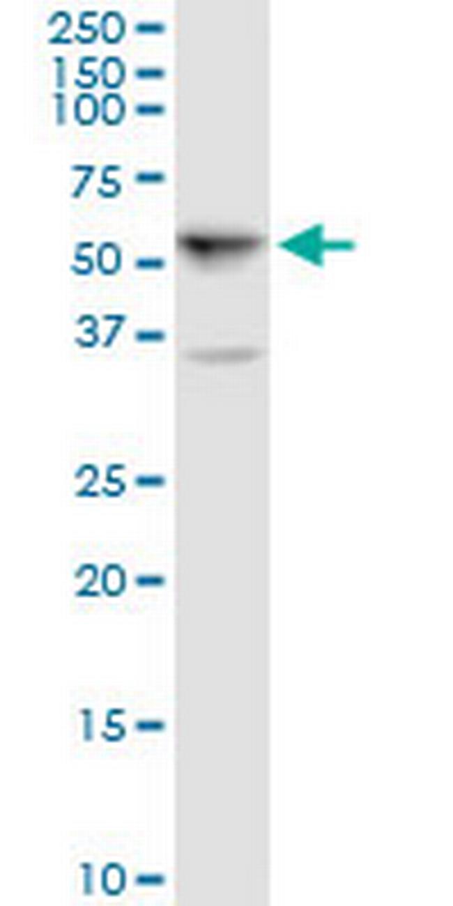 ALDH5A1 Antibody in Western Blot (WB)