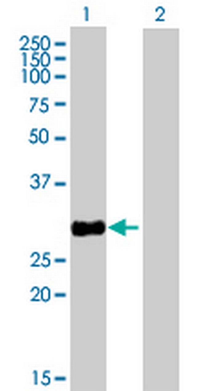 HSD17B8 Antibody in Western Blot (WB)