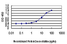 EPM2A Antibody in ELISA (ELISA)