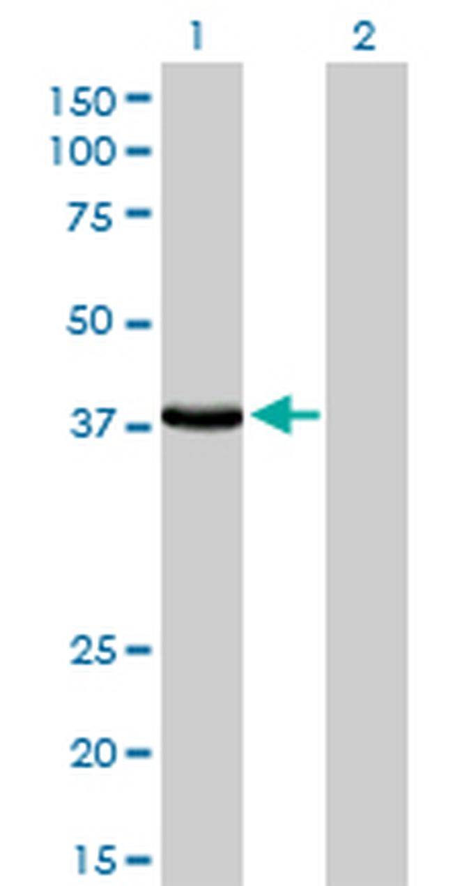 EPM2A Antibody in Western Blot (WB)