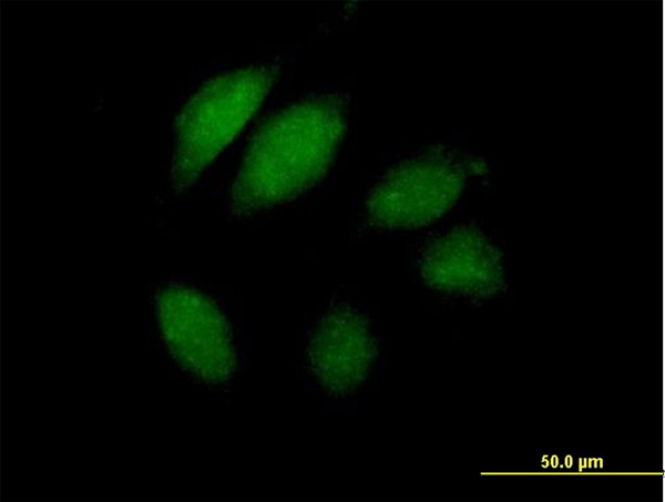 JTV1 Antibody in Immunocytochemistry (ICC/IF)