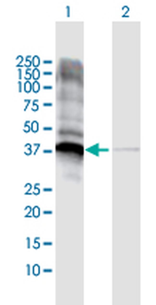 JTV1 Antibody in Western Blot (WB)