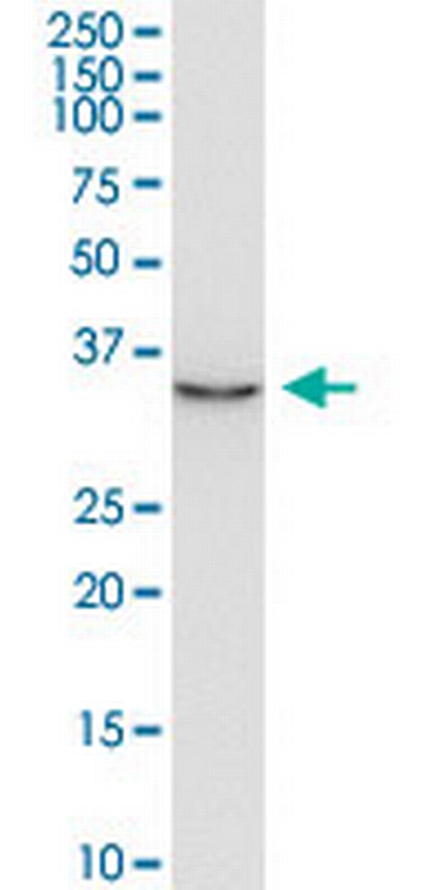 JTV1 Antibody in Western Blot (WB)