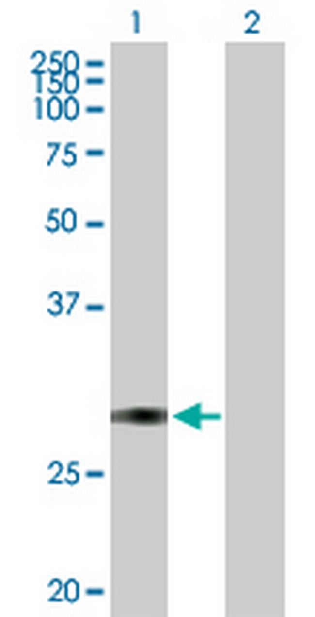 TFPI2 Antibody in Western Blot (WB)