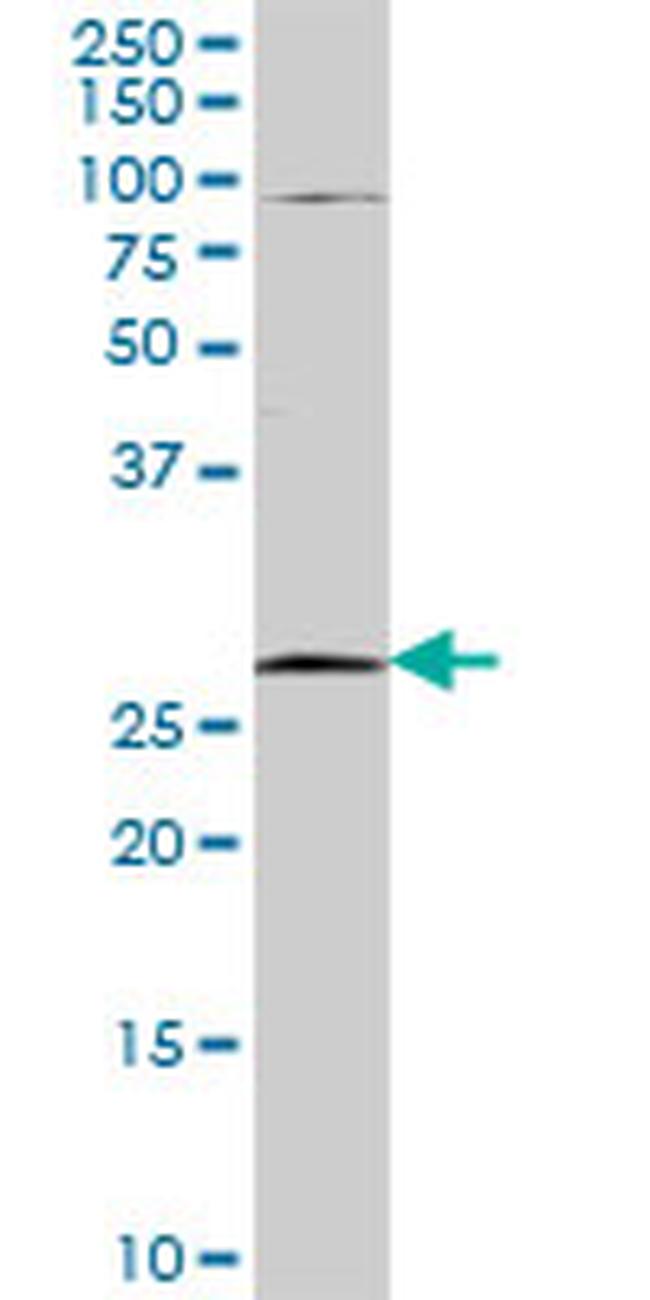 TFPI2 Antibody in Western Blot (WB)