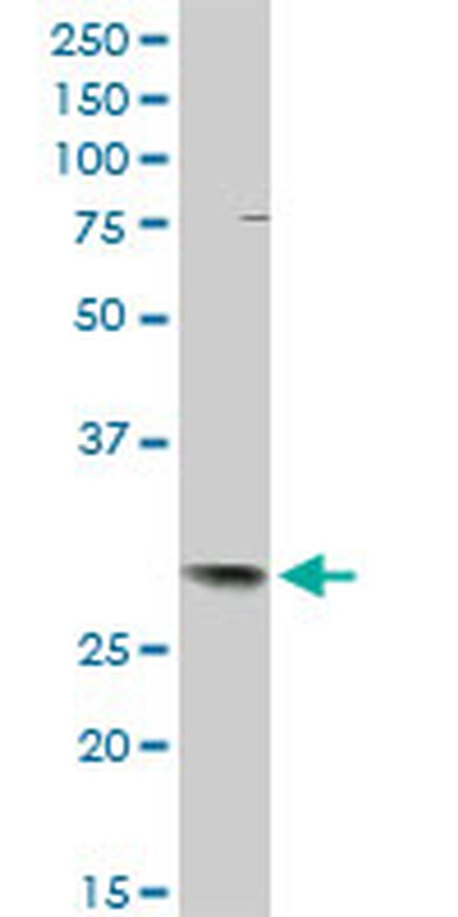 TFPI2 Antibody in Western Blot (WB)