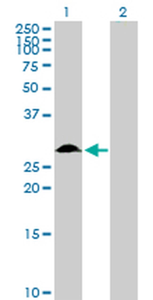 TFPI2 Antibody in Western Blot (WB)