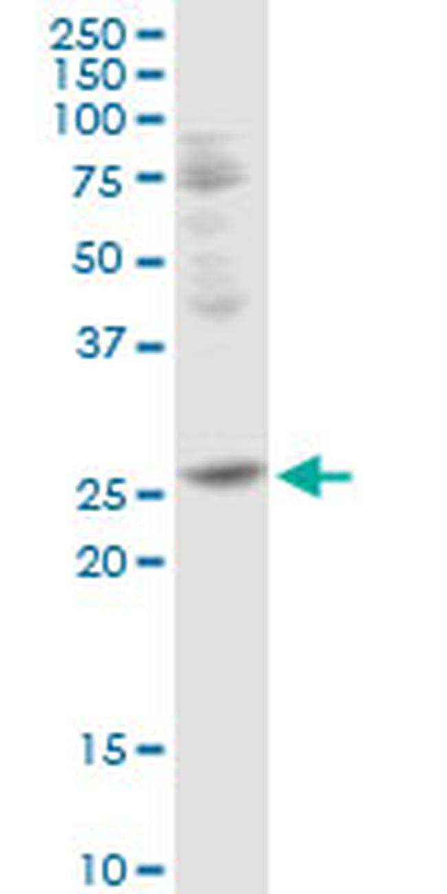 TFPI2 Antibody in Western Blot (WB)