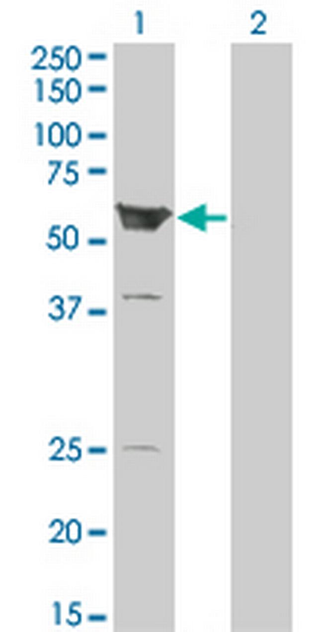 ARHGEF5 Antibody in Western Blot (WB)