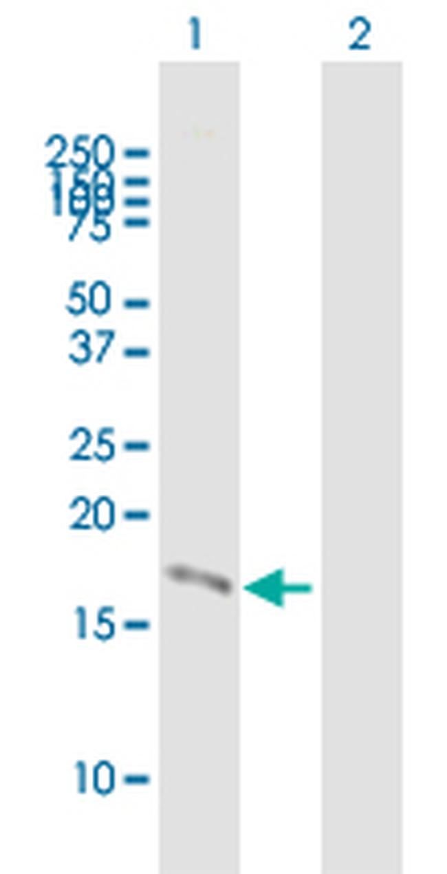 PSCA Antibody in Western Blot (WB)