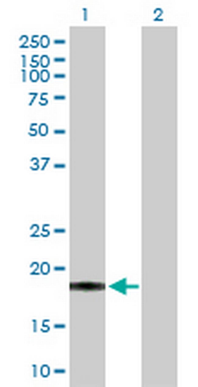 PSCA Antibody in Western Blot (WB)