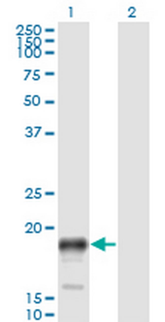 PSCA Antibody in Western Blot (WB)