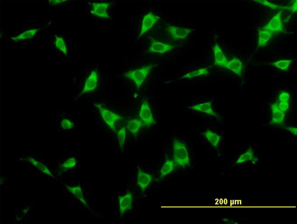 NCOA4 Antibody in Immunocytochemistry (ICC/IF)