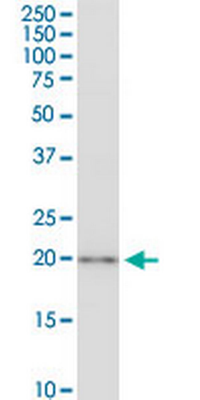 CSRP3 Antibody in Western Blot (WB)