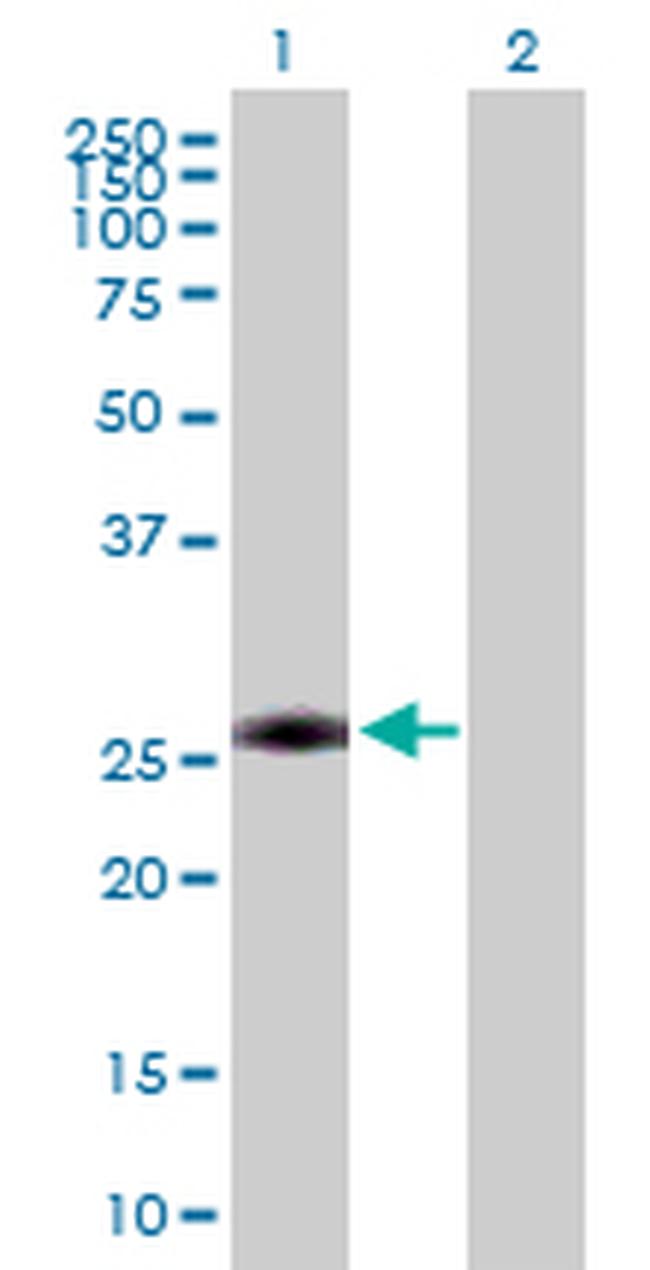 AAAS Antibody in Western Blot (WB)