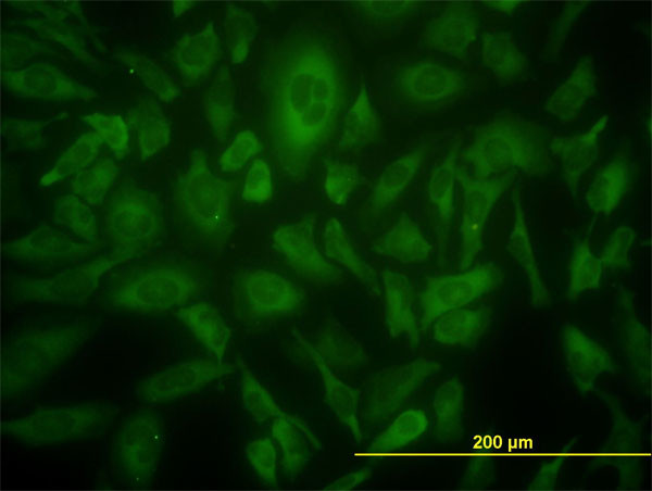 USP9X Antibody in Immunocytochemistry (ICC/IF)