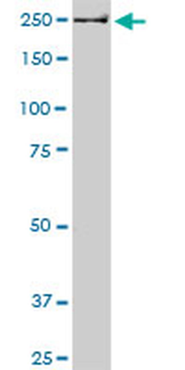 USP9X Antibody in Western Blot (WB)