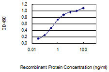 JARID1D Antibody in ELISA (ELISA)