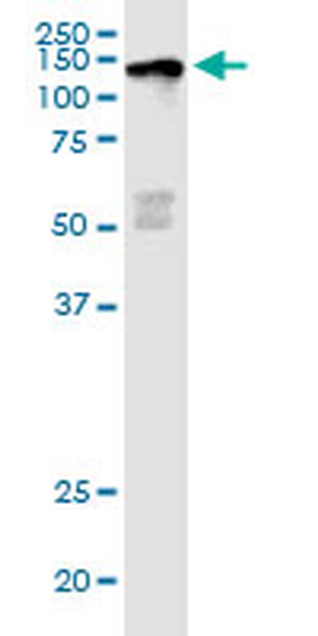 JARID1D Antibody in Western Blot (WB)