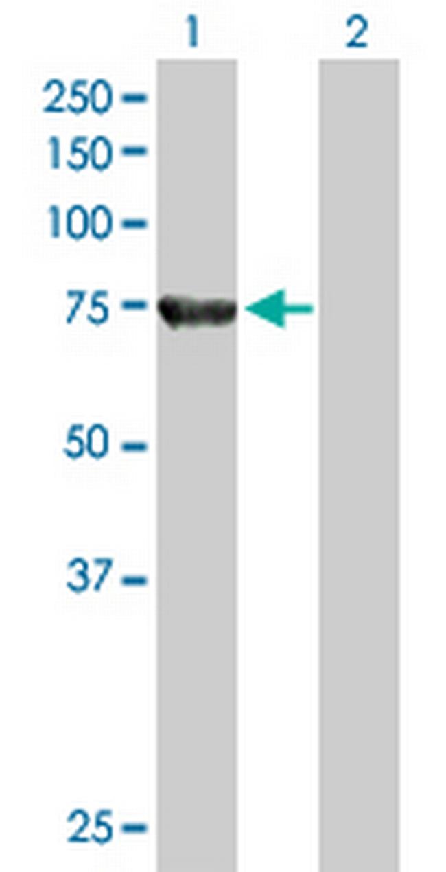 ACOX2 Antibody in Western Blot (WB)