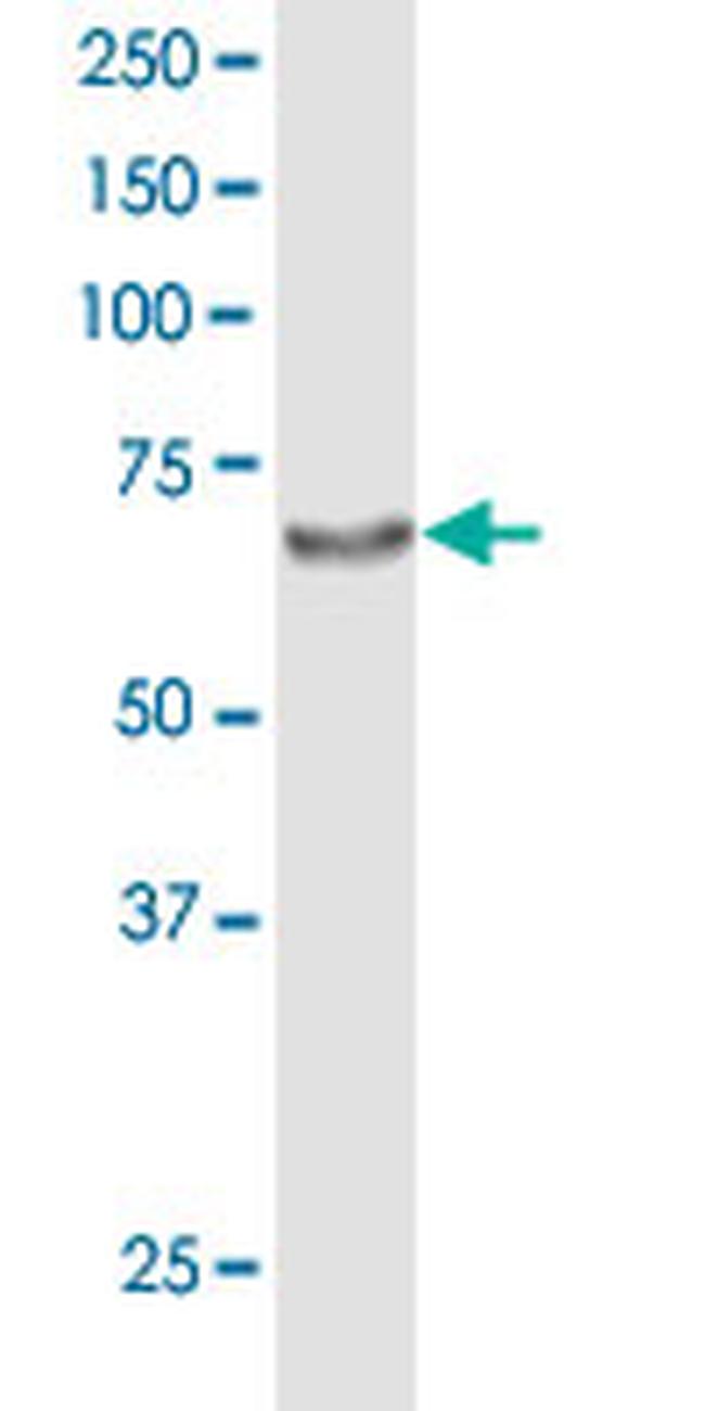 ACOX2 Antibody in Western Blot (WB)