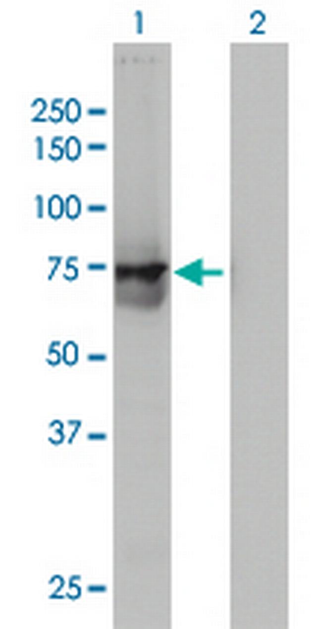 ACOX2 Antibody in Western Blot (WB)