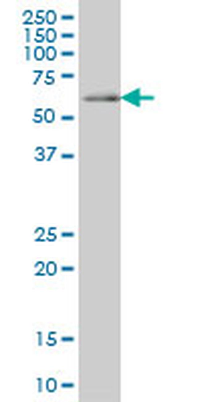 CDC45L Antibody in Western Blot (WB)