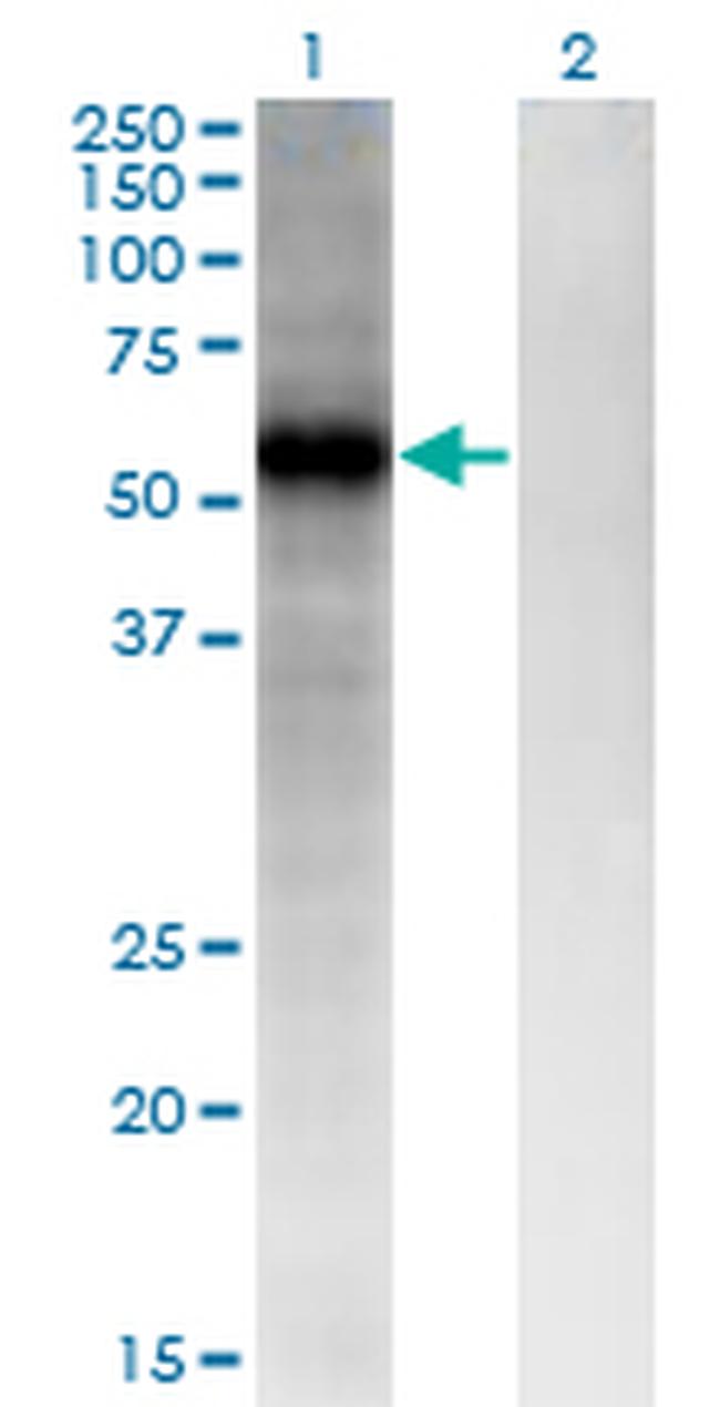 FZD4 Antibody in Western Blot (WB)