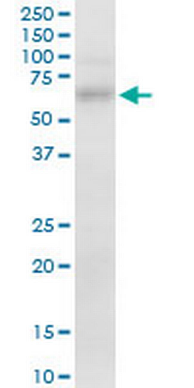 FZD7 Antibody in Western Blot (WB)