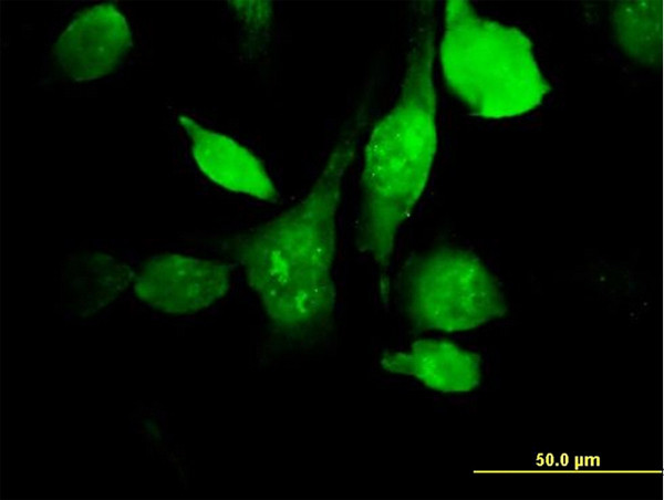 HYAL3 Antibody in Immunocytochemistry (ICC/IF)