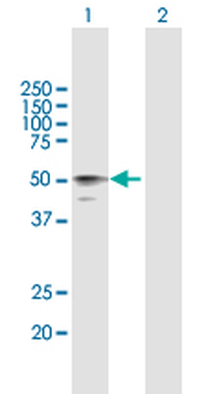 HYAL3 Antibody in Western Blot (WB)