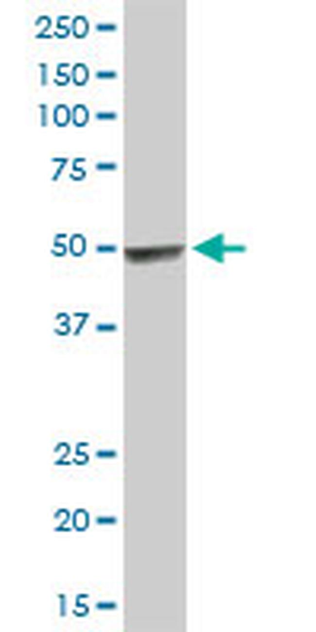 HYAL3 Antibody in Western Blot (WB)