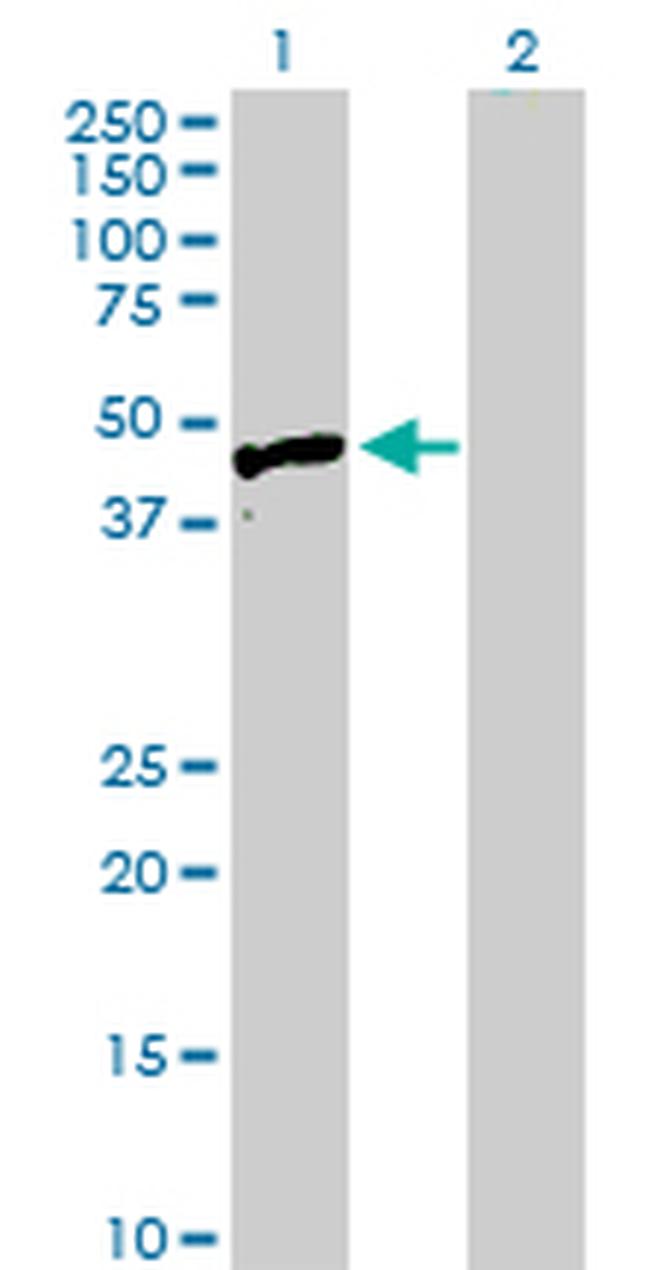 HYAL3 Antibody in Western Blot (WB)