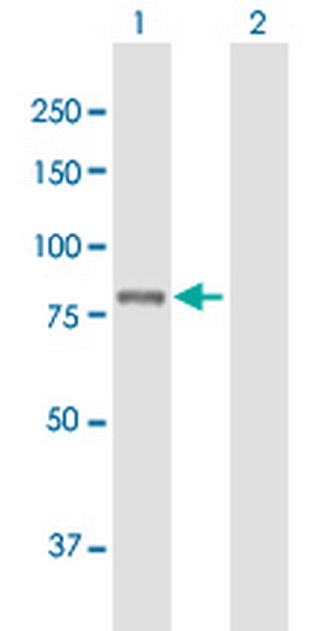 PLA2G6 Antibody in Western Blot (WB)