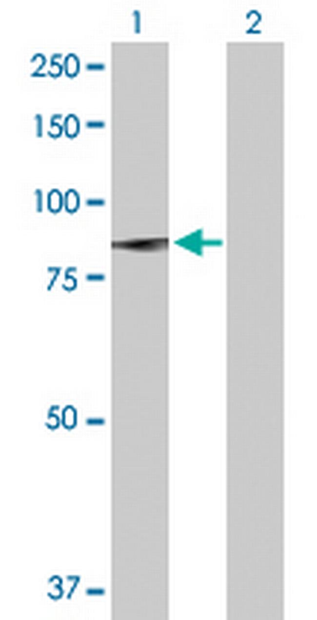 PLA2G6 Antibody in Western Blot (WB)