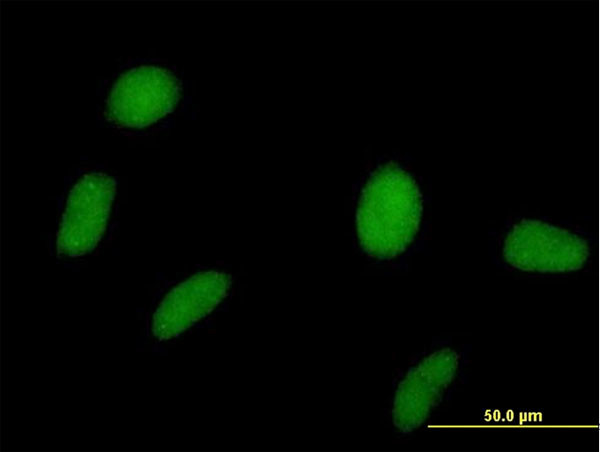 SPOP Antibody in Immunocytochemistry (ICC/IF)