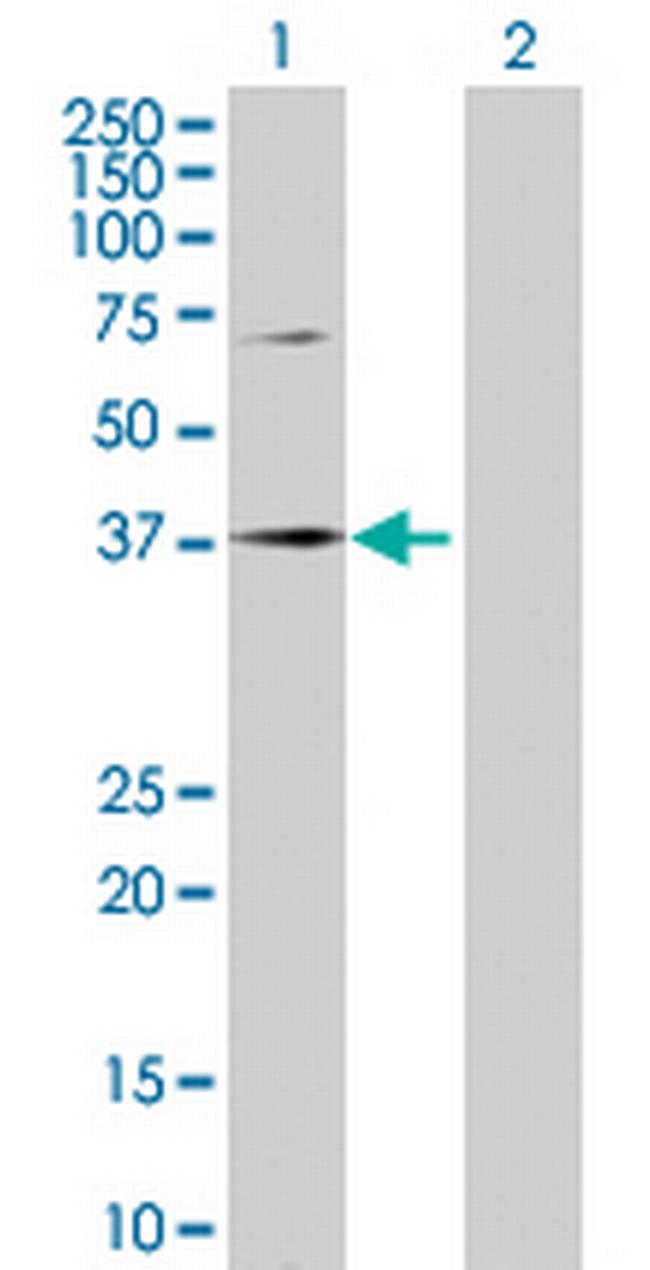 SPOP Antibody in Western Blot (WB)