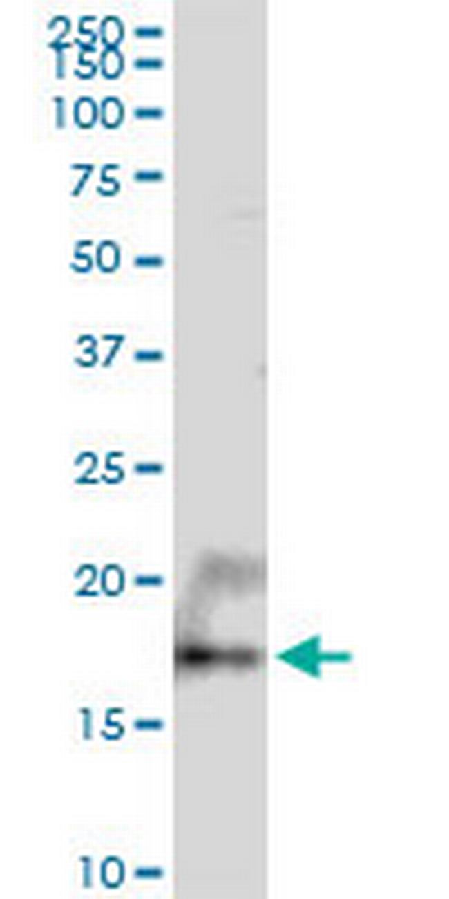 UXT Antibody in Western Blot (WB)