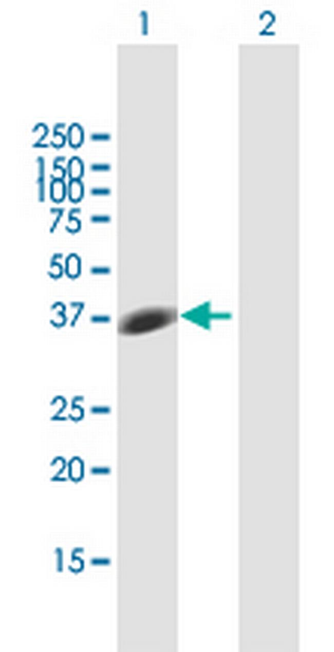 STX7 Antibody in Western Blot (WB)