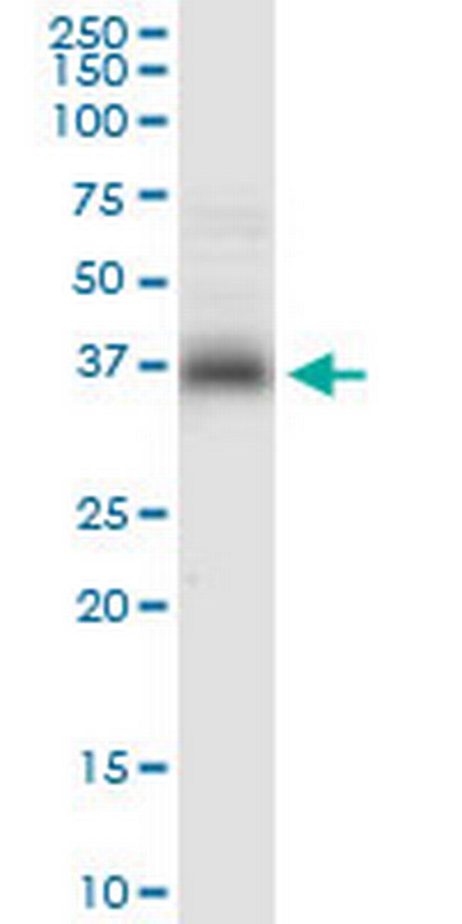 STX7 Antibody in Western Blot (WB)