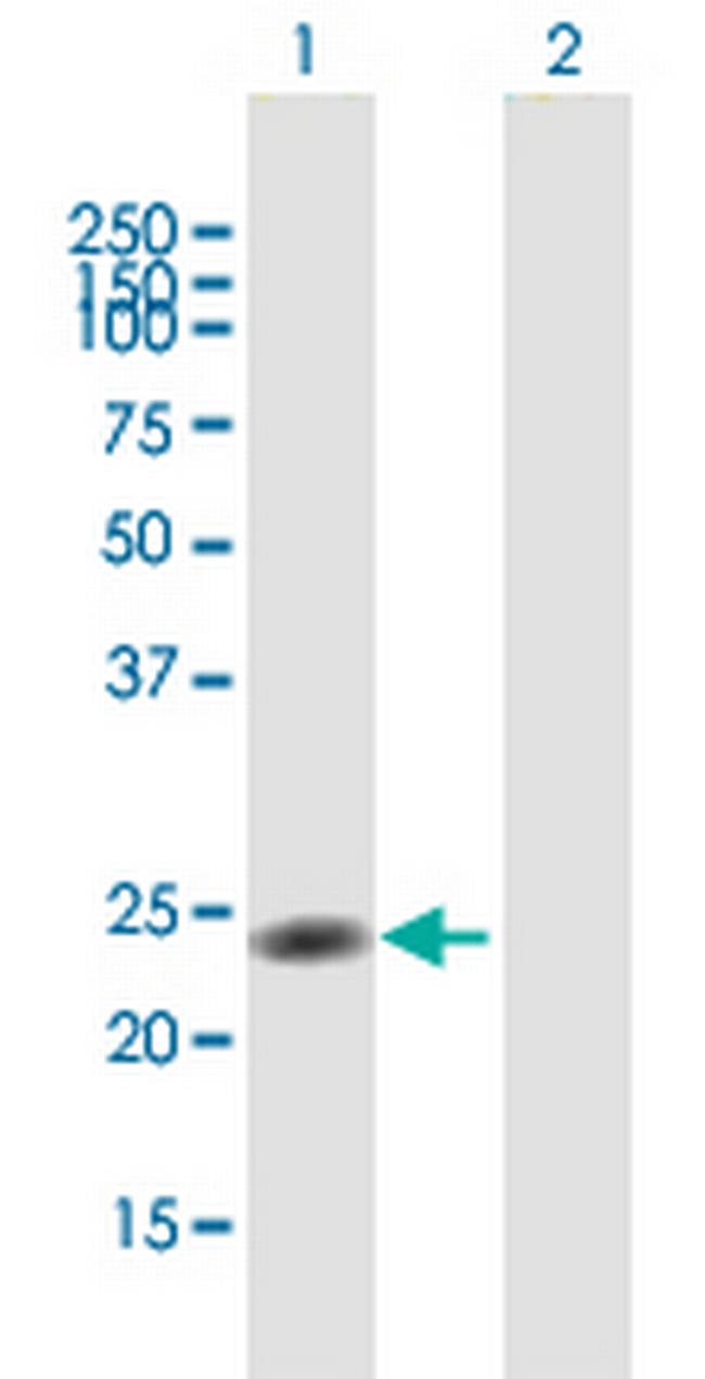 NR0B2 Antibody in Western Blot (WB)