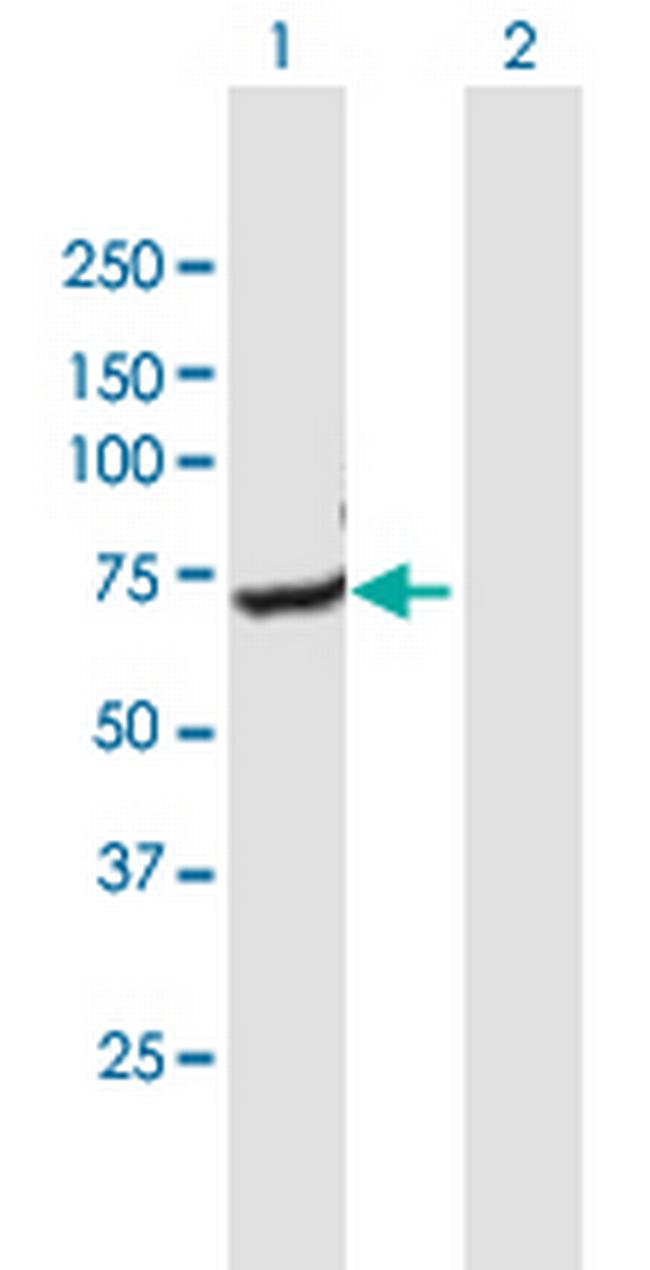 GNPAT Antibody in Western Blot (WB)