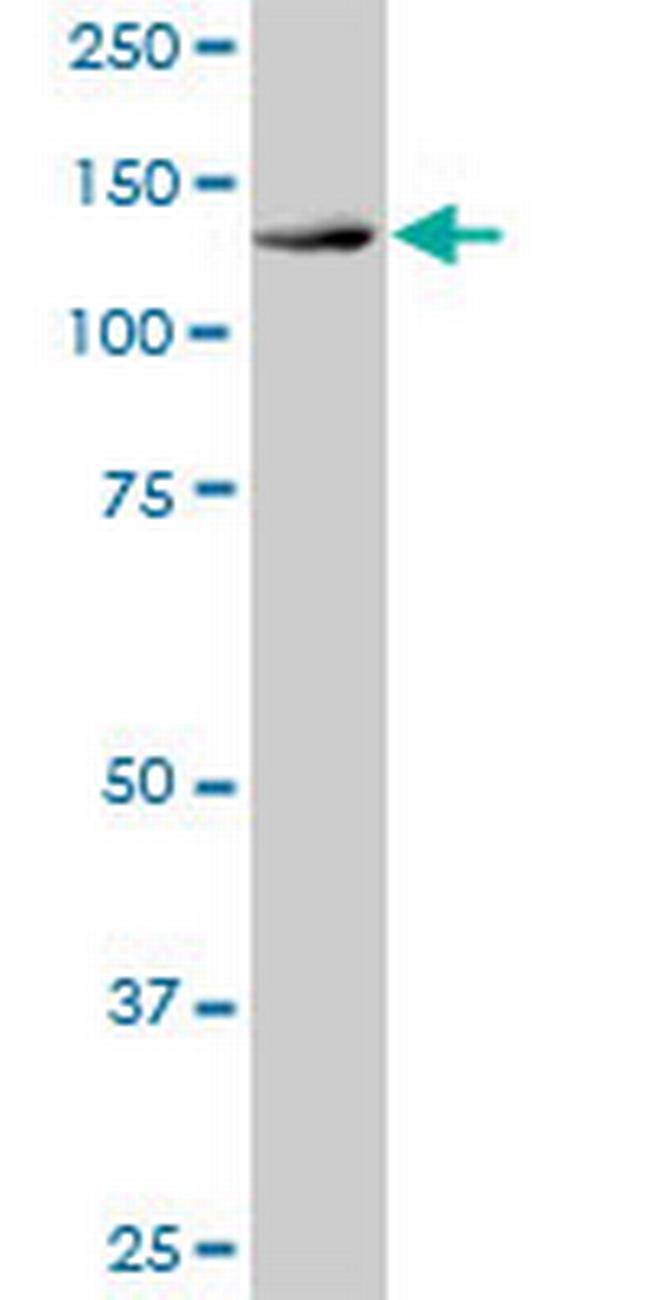 DHX16 Antibody in Western Blot (WB)