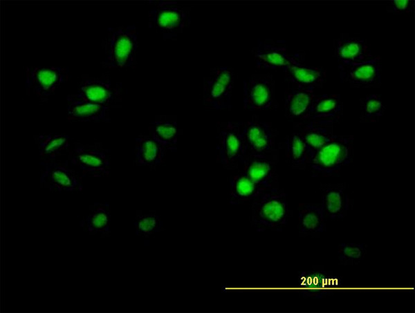 CUL4B Antibody in Immunocytochemistry (ICC/IF)