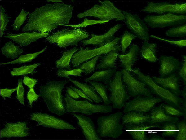 SEMA7A Antibody in Immunocytochemistry (ICC/IF)